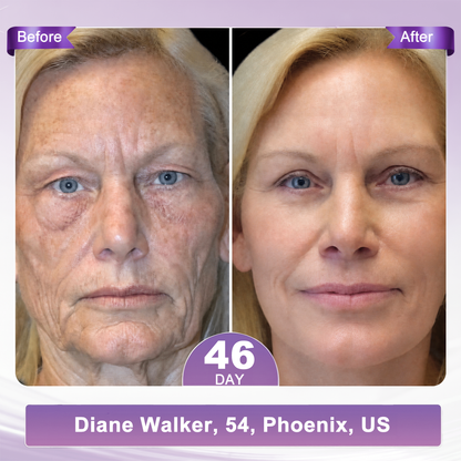 🔥 𝐖𝐫𝐢𝐧𝐤𝐥𝐞 𝐑𝐞𝐩𝐚𝐢𝐫 & 𝐒𝐤𝐢𝐧 𝐑𝐞𝐧𝐞𝐰𝐚𝐥 𝐂𝐫𝐞𝐚𝐦 — 𝐒𝐏𝐄𝐂𝐈𝐀𝐋 𝐁𝐎𝐍𝐔𝐒 𝐔𝐍𝐋𝐎𝐂𝐊𝐄𝐃! 𝟖𝟎% 𝐎𝐅𝐅 𝐇𝐈𝐒𝐊𝐈𝐍® | 𝐒𝐦𝐨𝐨𝐭𝐡 𝐅𝐢𝐧𝐞 𝐋𝐢𝐧𝐞𝐬, 𝐑𝐞𝐩𝐚𝐢𝐫 𝐒𝐤𝐢𝐧 𝐀𝐟𝐭𝐞𝐫 𝐒𝐩𝐨𝐭 𝐂𝐚𝐫𝐞 & 𝐑𝐞𝐯𝐞𝐚𝐥 𝐅𝐢𝐫𝐦𝐞𝐫, 𝐘𝐨𝐮𝐭𝐡𝐟𝐮𝐥-𝐋𝐨𝐨𝐤𝐢𝐧𝐠 𝐒𝐤𝐢𝐧