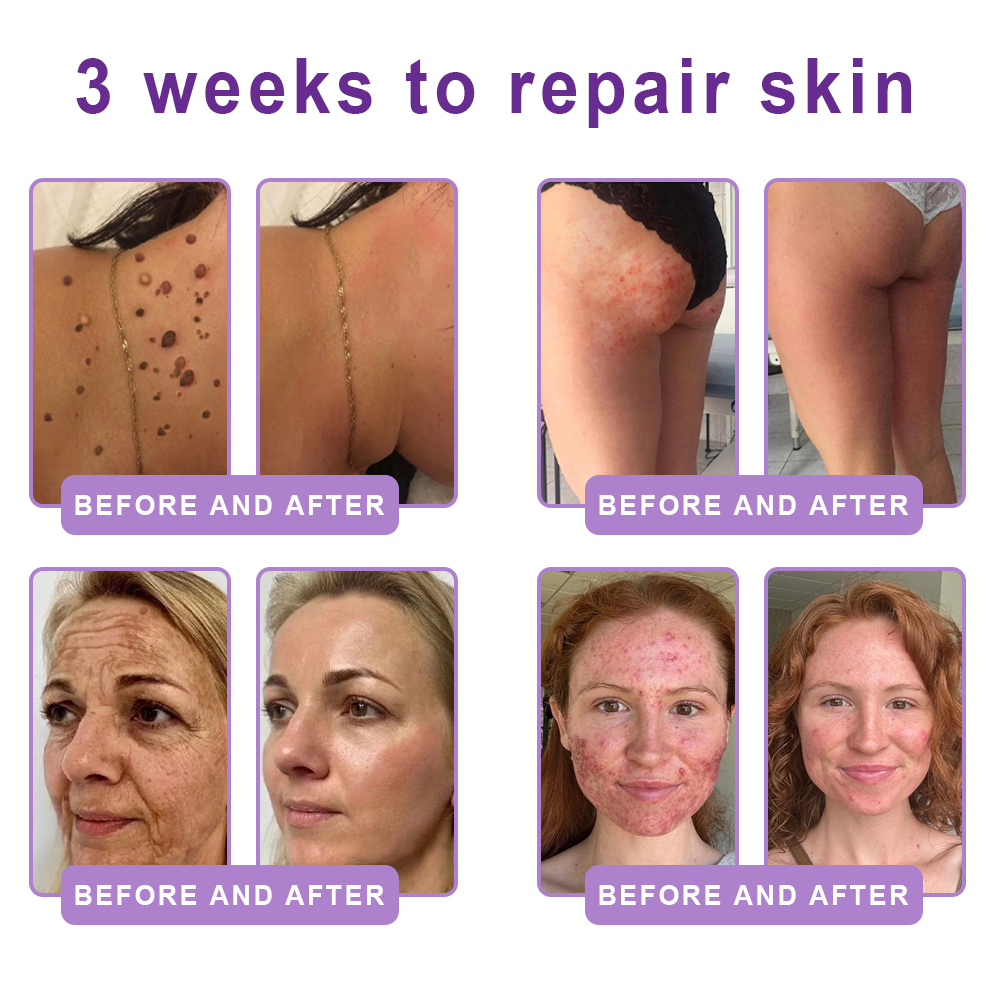 🎁 HISKIN® Only 5 Tubes Left! 50% OFF – Smooth Wrinkles & Firm Skin in 1-4 Weeks! Fast results, gentle on all skin types. 180-day money-back guarantee. Don’t miss out!
