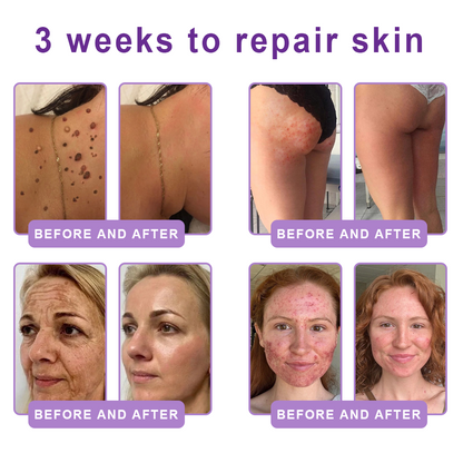 🎁 HISKIN® Only 5 Tubes Left! 50% OFF – Smooth Wrinkles & Firm Skin in 1-4 Weeks! Fast results, gentle on all skin types. 180-day money-back guarantee. Don’t miss out!