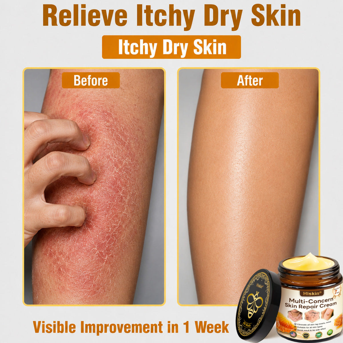 🔥 DON’T STOP AFTER SPOT CARE — Give Your Skin The Long-Term Care It Deserves With This Exclusive HISKIN® Repair Cream Upgrade!
