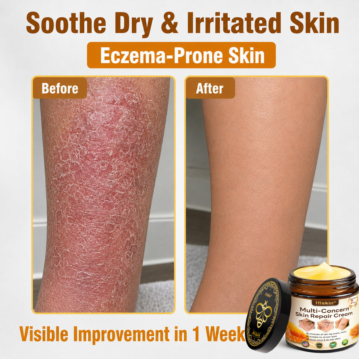 🔥 DON’T STOP AFTER SPOT CARE — Give Your Skin The Long-Term Care It Deserves With This Exclusive HISKIN® Repair Cream Upgrade!
