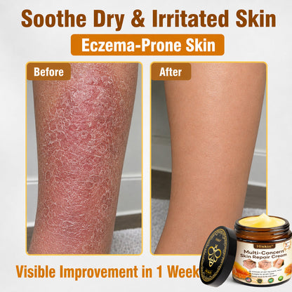 🔥 DON’T STOP AFTER SPOT CARE — Give Your Skin The Long-Term Care It Deserves With This Exclusive HISKIN® Repair Cream Upgrade!