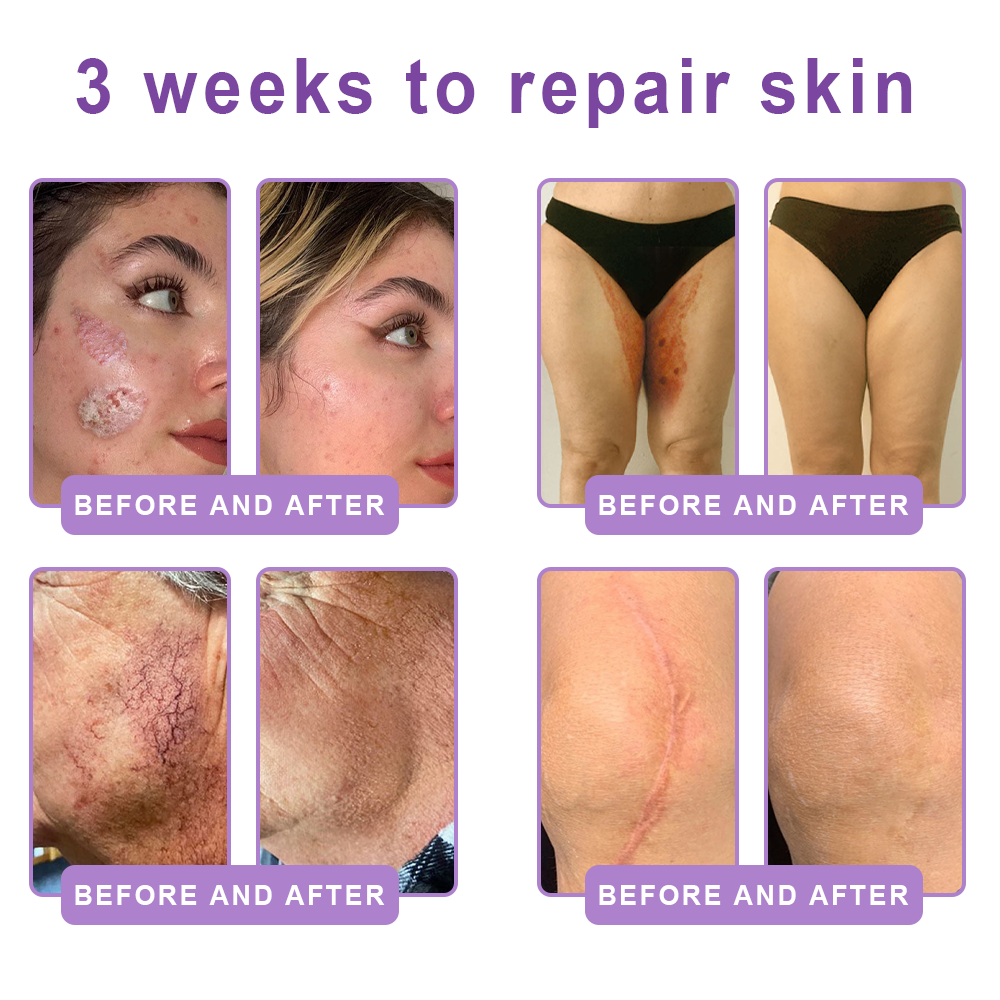 🎁 HISKIN® Only 5 Tubes Left! 50% OFF – Smooth Wrinkles & Firm Skin in 1-4 Weeks! Fast results, gentle on all skin types. 180-day money-back guarantee. Don’t miss out!