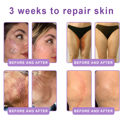 🎁 HISKIN® Only 5 Tubes Left! 50% OFF – Smooth Wrinkles & Firm Skin in 1-4 Weeks! Fast results, gentle on all skin types. 180-day money-back guarantee. Don’t miss out!