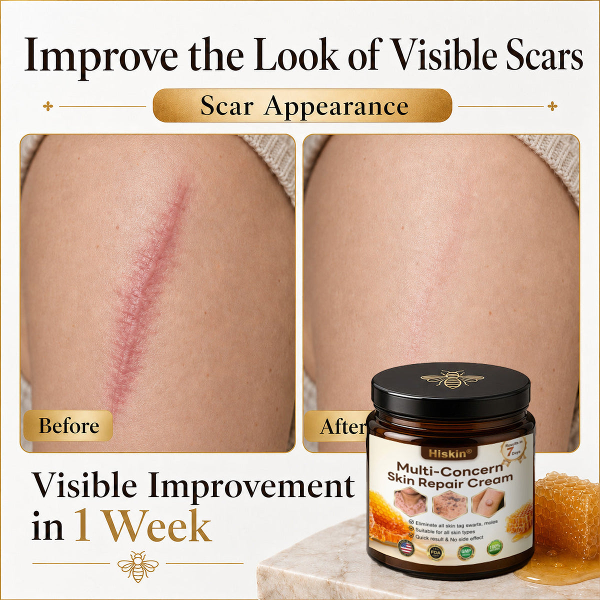 🔥 DON’T STOP AFTER SPOT CARE — Give Your Skin The Long-Term Care It Deserves With This Exclusive HISKIN® Repair Cream Upgrade!