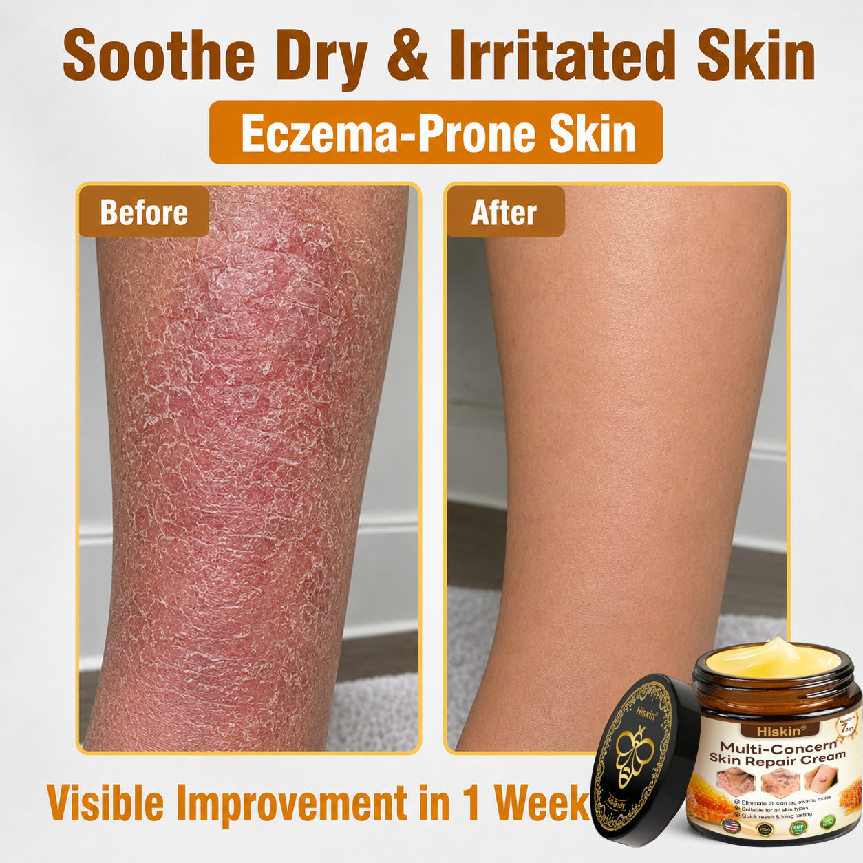 ✨🐝𝐇𝐈𝐒𝐊𝐈𝐍® 𝐌𝐮𝐥𝐭𝐢-𝐂𝐨𝐧𝐜𝐞𝐫𝐧 𝐒𝐤𝐢𝐧 𝐑𝐞𝐩𝐚𝐢𝐫 𝐂𝐫𝐞𝐚𝐦 (𝐎𝐧𝐞 𝐩𝐨𝐰𝐞𝐫𝐟𝐮𝐥 𝐜𝐫𝐞𝐚𝐦 𝐭𝐨 𝐫𝐞𝐩𝐚𝐢𝐫 𝐢𝐧𝐟𝐥𝐚𝐦𝐦𝐚𝐭𝐢𝐨𝐧, 𝐝𝐫𝐲𝐧𝐞𝐬𝐬, 𝐚𝐠𝐢𝐧𝐠, 𝐩𝐢𝐠𝐦𝐞𝐧𝐭𝐚𝐭𝐢𝐨𝐧, 𝐚𝐧𝐝 𝐯𝐢𝐬𝐢𝐛𝐥𝐞 𝐬𝐤𝐢𝐧 𝐝𝐚𝐦𝐚𝐠𝐞.)