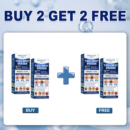 🎁 𝐇𝐈𝐒𝐊𝐈𝐍® 𝐋𝐚𝐬𝐭 𝐂𝐡𝐚𝐧𝐜𝐞! 𝟓𝟎% 𝐎𝐅𝐅 𝐒𝐤𝐢𝐧 𝐓𝐚𝐠 & 𝐒𝐩𝐨𝐭 𝐄𝐫𝐚𝐬𝐞𝐫 𝐏𝐞𝐧 — 𝐒𝐦𝐨𝐨𝐭𝐡 𝐀𝐰𝐚𝐲 𝐓𝐡𝐞 𝐋𝐨𝐨𝐤 𝐎𝐟 𝐔𝐧𝐰𝐚𝐧𝐭𝐞𝐝 𝐁𝐮𝐦𝐩𝐬 & 𝐒𝐤𝐢𝐧 𝐈𝐦𝐩𝐞𝐫𝐟𝐞𝐜𝐭𝐢𝐨𝐧𝐬 𝐍𝐚𝐭𝐮𝐫𝐚𝐥𝐥𝐲. 𝐅𝐫𝐞𝐞 𝐒𝐡𝐢𝐩𝐩𝐢𝐧𝐠 + 𝟏𝟖𝟎-𝐃𝐚𝐲 𝐆𝐮𝐚𝐫𝐚𝐧𝐭𝐞𝐞