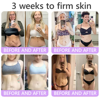 🎁 HISKIN® Only 5 Tubes Left! 50% OFF – Smooth Wrinkles & Firm Skin in 1-4 Weeks! Fast results, gentle on all skin types. 180-day money-back guarantee. Don’t miss out!