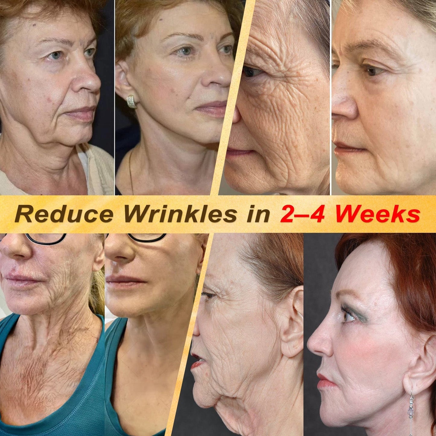 ✨🐝𝐇𝐈𝐒𝐊𝐈𝐍® 𝐌𝐮𝐥𝐭𝐢-𝐂𝐨𝐧𝐜𝐞𝐫𝐧 𝐒𝐤𝐢𝐧 𝐑𝐞𝐩𝐚𝐢𝐫 𝐂𝐫𝐞𝐚𝐦 (𝐎𝐧𝐞 𝐩𝐨𝐰𝐞𝐫𝐟𝐮𝐥 𝐜𝐫𝐞𝐚𝐦 𝐭𝐨 𝐫𝐞𝐩𝐚𝐢𝐫 𝐢𝐧𝐟𝐥𝐚𝐦𝐦𝐚𝐭𝐢𝐨𝐧, 𝐝𝐫𝐲𝐧𝐞𝐬𝐬, 𝐚𝐠𝐢𝐧𝐠, 𝐩𝐢𝐠𝐦𝐞𝐧𝐭𝐚𝐭𝐢𝐨𝐧, 𝐚𝐧𝐝 𝐯𝐢𝐬𝐢𝐛𝐥𝐞 𝐬𝐤𝐢𝐧 𝐝𝐚𝐦𝐚𝐠𝐞.)