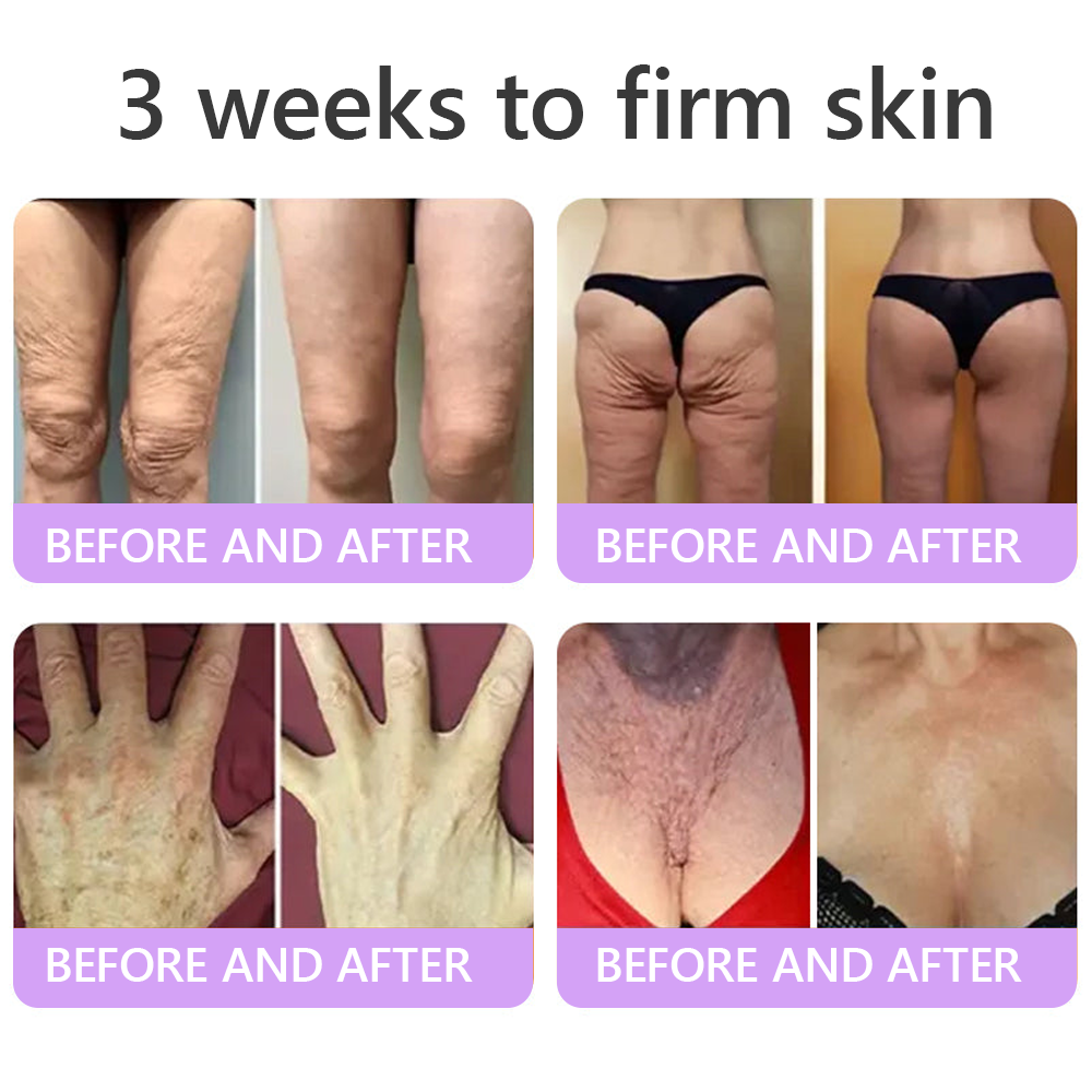 🎁 HISKIN® Only 5 Tubes Left! 50% OFF – Smooth Wrinkles & Firm Skin in 1-4 Weeks! Fast results, gentle on all skin types. 180-day money-back guarantee. Don’t miss out!