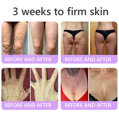 🎁 HISKIN® Only 5 Tubes Left! 50% OFF – Smooth Wrinkles & Firm Skin in 1-4 Weeks! Fast results, gentle on all skin types. 180-day money-back guarantee. Don’t miss out!