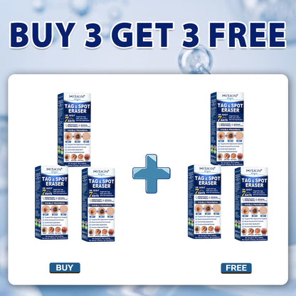 🎁 𝐇𝐈𝐒𝐊𝐈𝐍® 𝐋𝐚𝐬𝐭 𝐂𝐡𝐚𝐧𝐜𝐞! 𝟓𝟎% 𝐎𝐅𝐅 𝐒𝐤𝐢𝐧 𝐓𝐚𝐠 & 𝐒𝐩𝐨𝐭 𝐄𝐫𝐚𝐬𝐞𝐫 𝐏𝐞𝐧 — 𝐒𝐦𝐨𝐨𝐭𝐡 𝐀𝐰𝐚𝐲 𝐓𝐡𝐞 𝐋𝐨𝐨𝐤 𝐎𝐟 𝐔𝐧𝐰𝐚𝐧𝐭𝐞𝐝 𝐁𝐮𝐦𝐩𝐬 & 𝐒𝐤𝐢𝐧 𝐈𝐦𝐩𝐞𝐫𝐟𝐞𝐜𝐭𝐢𝐨𝐧𝐬 𝐍𝐚𝐭𝐮𝐫𝐚𝐥𝐥𝐲. 𝐅𝐫𝐞𝐞 𝐒𝐡𝐢𝐩𝐩𝐢𝐧𝐠 + 𝟏𝟖𝟎-𝐃𝐚𝐲 𝐆𝐮𝐚𝐫𝐚𝐧𝐭𝐞𝐞