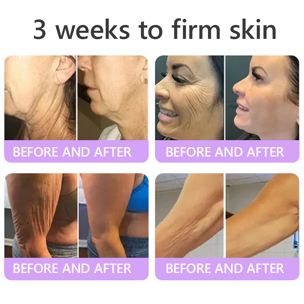 🎁 HISKIN® Only 5 Tubes Left! 50% OFF – Smooth Wrinkles & Firm Skin in 1-4 Weeks! Fast results, gentle on all skin types. 180-day money-back guarantee. Don’t miss out!