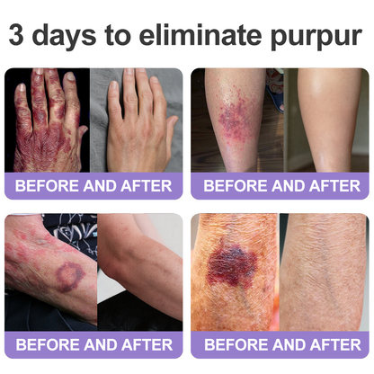 🔥🔥 𝐇𝐈𝐒𝐊𝐈𝐍® 𝟕-𝐃𝐚𝐲 𝐒𝐤𝐢𝐧 𝐓𝐚𝐠 & 𝐒𝐩𝐨𝐭 𝐄𝐫𝐚𝐬𝐞𝐫 𝐑𝐨𝐥𝐥𝐞𝐫𝐛𝐚𝐥𝐥 𝐏𝐞𝐧 🍀 | 𝐓𝐚𝐫𝐠𝐞𝐭𝐬 𝐒𝐤𝐢𝐧 𝐓𝐚𝐠𝐬, 𝐀𝐠𝐞 𝐒𝐩𝐨𝐭𝐬, 𝐃𝐚𝐫𝐤 𝐒𝐩𝐨𝐭𝐬 & 𝐁𝐥𝐞𝐦𝐢𝐬𝐡𝐞𝐬 | 𝐎𝐧𝐜𝐞 𝐃𝐚𝐢𝐥𝐲 𝐀𝐩𝐩𝐥𝐢𝐜𝐚𝐭𝐢𝐨𝐧 | 𝐕𝐢𝐬𝐢𝐛𝐥𝐞 𝐑𝐞𝐬𝐮𝐥𝐭𝐬 𝐢𝐧 𝟕 𝐃𝐚𝐲𝐬𝐨𝐭𝐬, 𝐃𝐚𝐫𝐤 𝐒𝐩𝐨𝐭𝐬 & 𝐁𝐥𝐞𝐦𝐢𝐬𝐡𝐞𝐬 | 𝐎𝐧𝐜𝐞 𝐃𝐚𝐢𝐥𝐲 𝐀𝐩𝐩𝐥𝐢𝐜𝐚𝐭𝐢𝐨𝐧 | 𝐕𝐢𝐬𝐢𝐛𝐥𝐞 𝐑𝐞𝐬𝐮𝐥𝐭𝐬 𝐢𝐧 𝟕 𝐃𝐚𝐲𝐬
