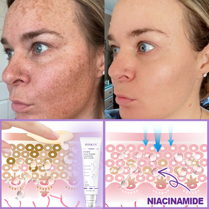 🎁 HISKIN® Only 5 Tubes Left! 50% OFF – Smooth Wrinkles & Firm Skin in 1-4 Weeks! Fast results, gentle on all skin types. 180-day money-back guarantee. Don’t miss out!