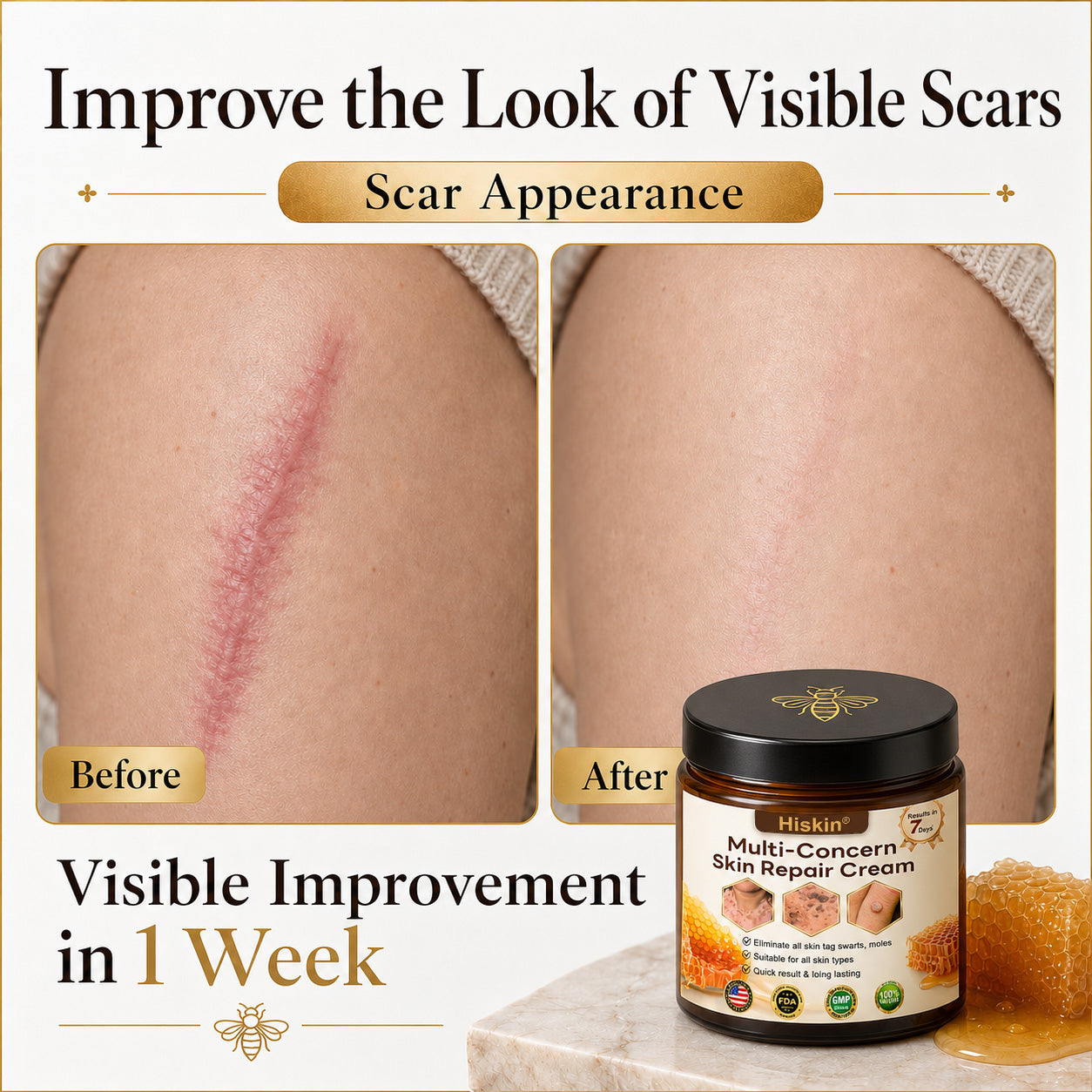 ✨🐝𝐇𝐈𝐒𝐊𝐈𝐍® 𝐌𝐮𝐥𝐭𝐢-𝐂𝐨𝐧𝐜𝐞𝐫𝐧 𝐒𝐤𝐢𝐧 𝐑𝐞𝐩𝐚𝐢𝐫 𝐂𝐫𝐞𝐚𝐦 (𝐎𝐧𝐞 𝐩𝐨𝐰𝐞𝐫𝐟𝐮𝐥 𝐜𝐫𝐞𝐚𝐦 𝐭𝐨 𝐫𝐞𝐩𝐚𝐢𝐫 𝐢𝐧𝐟𝐥𝐚𝐦𝐦𝐚𝐭𝐢𝐨𝐧, 𝐝𝐫𝐲𝐧𝐞𝐬𝐬, 𝐚𝐠𝐢𝐧𝐠, 𝐩𝐢𝐠𝐦𝐞𝐧𝐭𝐚𝐭𝐢𝐨𝐧, 𝐚𝐧𝐝 𝐯𝐢𝐬𝐢𝐛𝐥𝐞 𝐬𝐤𝐢𝐧 𝐝𝐚𝐦𝐚𝐠𝐞.)