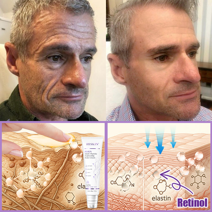 🎁 HISKIN® Only 5 Tubes Left! 50% OFF – Smooth Wrinkles & Firm Skin in 1-4 Weeks! Fast results, gentle on all skin types. 180-day money-back guarantee. Don’t miss out!