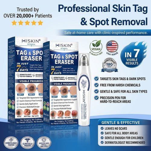 🎁 𝐇𝐈𝐒𝐊𝐈𝐍® 𝐋𝐚𝐬𝐭 𝐂𝐡𝐚𝐧𝐜𝐞! 𝟓𝟎% 𝐎𝐅𝐅 𝐒𝐤𝐢𝐧 𝐓𝐚𝐠 & 𝐒𝐩𝐨𝐭 𝐄𝐫𝐚𝐬𝐞𝐫 𝐏𝐞𝐧 — 𝐒𝐦𝐨𝐨𝐭𝐡 𝐀𝐰𝐚𝐲 𝐓𝐡𝐞 𝐋𝐨𝐨𝐤 𝐎𝐟 𝐔𝐧𝐰𝐚𝐧𝐭𝐞𝐝 𝐁𝐮𝐦𝐩𝐬 & 𝐒𝐤𝐢𝐧 𝐈𝐦𝐩𝐞𝐫𝐟𝐞𝐜𝐭𝐢𝐨𝐧𝐬 𝐍𝐚𝐭𝐮𝐫𝐚𝐥𝐥𝐲. 𝐅𝐫𝐞𝐞 𝐒𝐡𝐢𝐩𝐩𝐢𝐧𝐠 + 𝟏𝟖𝟎-𝐃𝐚𝐲 𝐆𝐮𝐚𝐫𝐚𝐧𝐭𝐞𝐞