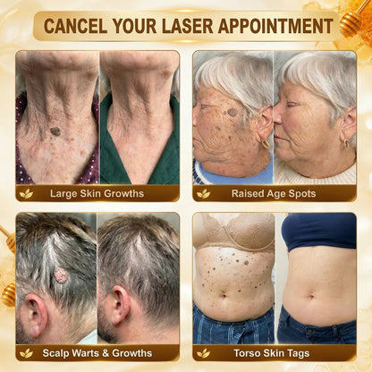 🎉 LUCKY YOU! Your Exclusive 80% OFF Skin Upgrade Is Ready! HISKIN® Repair Microneedle Patches | Just Apply & Go For Easy Skin Nourishment, Hydration & Smoother-Looking Skin + 180-Day Guarantee