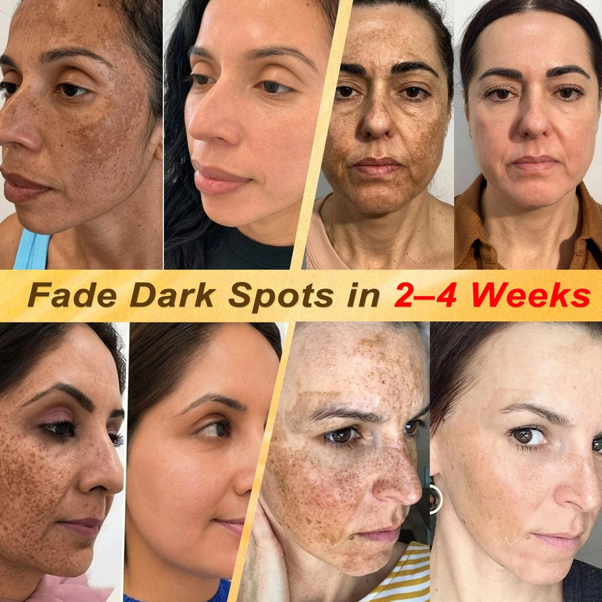 🏥👩‍⚕️𝐇𝐈𝐒𝐊𝐈𝐍®✨ 𝟕-𝐃𝒂𝘆 𝐒𝗸𝐢𝐧 𝐓𝒂𝗴 & 𝐒𝐩𝙤𝐭 𝐄𝐫𝒂𝐬𝙚𝐫 𝐏𝐚𝐢𝐧𝐥𝐞𝐬𝐬 & 𝐒𝐜𝐚𝐫-𝐅𝐫𝐞𝐞 𝐀𝐝𝐯𝐚𝐧𝐜𝐞𝐝 𝐈𝐦𝐩𝐞𝐫𝐟𝐞𝐜𝐭𝐢𝐨𝐧 𝐑𝐞𝐦𝐨𝐯𝐚𝐥 𝐑𝐨𝐥𝐥𝐞𝐫𝐛𝐚𝐥𝐥 𝐏𝐞𝐧