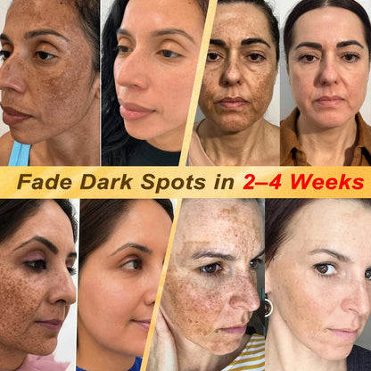 🏥👩‍⚕️𝐇𝐈𝐒𝐊𝐈𝐍®✨ 𝟕-𝐃𝒂𝘆 𝐒𝗸𝐢𝐧 𝐓𝒂𝗴 & 𝐒𝐩𝙤𝐭 𝐄𝐫𝒂𝐬𝙚𝐫 𝐏𝐚𝐢𝐧𝐥𝐞𝐬𝐬 & 𝐒𝐜𝐚𝐫-𝐅𝐫𝐞𝐞 𝐀𝐝𝐯𝐚𝐧𝐜𝐞𝐝 𝐈𝐦𝐩𝐞𝐫𝐟𝐞𝐜𝐭𝐢𝐨𝐧 𝐑𝐞𝐦𝐨𝐯𝐚𝐥 𝐑𝐨𝐥𝐥𝐞𝐫𝐛𝐚𝐥𝐥 𝐏𝐞𝐧